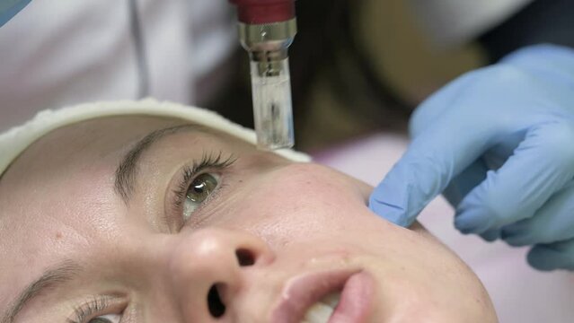 Shot of beautician doing dermapen mesotherapy injection on face for rejuvenation in spa, 4k video.
