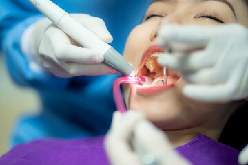 close-up of an open female mouth in a dentist office.