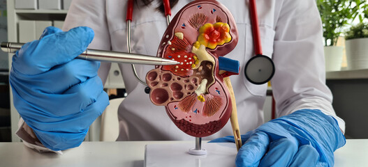 Treatment of kidney diseases and pyelonephritis closeup