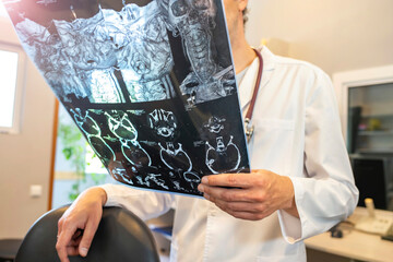 Diagnosis of brain disease. The doctor examines a magnetic resonance imaging (MRI) scan of the patient.