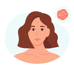 Herpes on the lip of a young woman. Inflammation of the lips. Skin care and health problems concept. Vector illustration