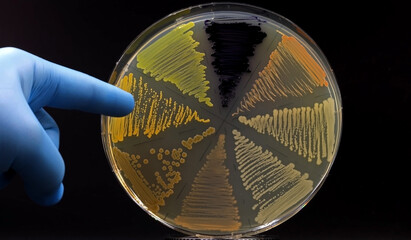 Hand of doctor or researcher holding a plate of microbiological cultures with colored bacteria....