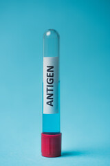 Close up view of test tube with antigen lettering on blue background.