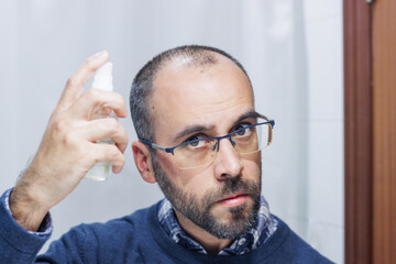 Obraz premium Young man with alopecia looking at his head and hair in the mirror and applying a spray medicine at home