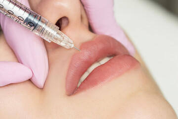 Lip augmentation and correction procedure in a cosmetology salon. The specialist makes an injection in the patient lips.