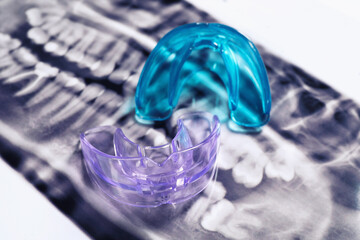 Mouth guards on dental scan, closeup. Bite correction