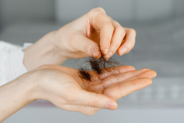 hair loss problem on hand