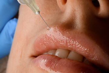 Obraz premium close-up of pink female lips and syringe needle with botox injection.