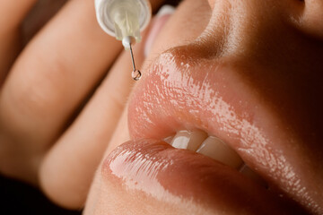 macro photography of female lips and syringe needle with botox injection.