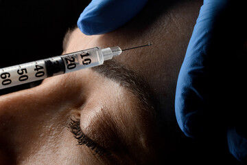 Close-up of female forehead and syringe with needle making an injection of botox