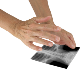 Holding a black and white photo of a neck xray in one hand with the other hand hovering above channeling healing energy transparent png file