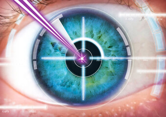 eye laser operation, pupil