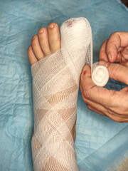Helping to injured and cut toe  and toe nail with blood soaking bandage.