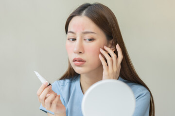 Dermatology, asian young woman looking at mirror, holding cream tube in hand, expression worry and itch, itchy allergy or allergic sensitive reaction, red or rash on face. Beauty care of skin problem - obrazy, fototapety, plakaty