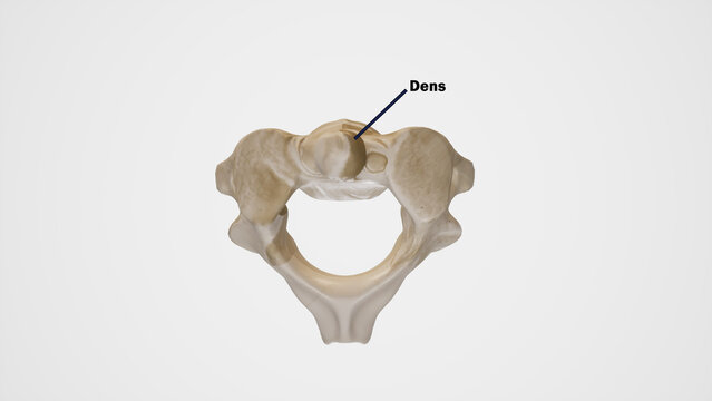 Dens of Axis