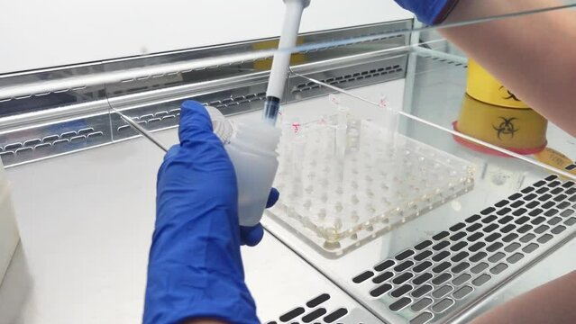Close-up, a scientist adds reagents in test tubes with a large automatic dispenser. Work in the laboratory with bacteria.