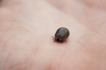 Fully fed tick on human hand. Close-up view of parasite on skin..