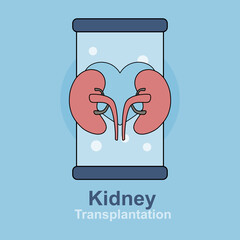 kidney transplantation,Cleansing and transfusion of blood through a dialysis machine,Modern process inner organs disease treatment,Vector illustration.