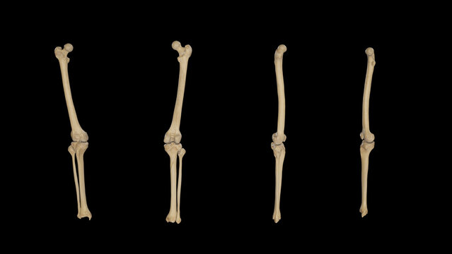 Thigh and Leg Bones-Multiple Views