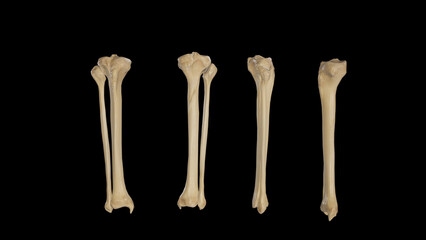 Bones of Right Leg-Multiple Views