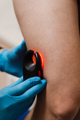 Veins scanning device that uses infrared light to detect the subcutaneous vascular map. Venous led...