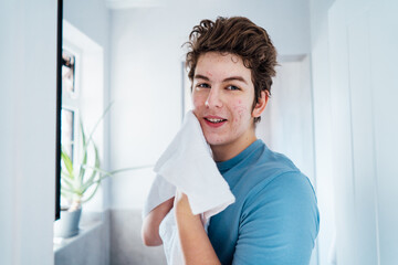 Portrait of smiling teenage boy with acne problem who takes care his face skin at home. He looking...