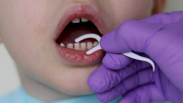 kid dentist visit open mouth doctor in surgical purple gloves chicking milk teeth with mouth mirror teaching how to use toothpick flossing importance.bottom face child boy diastema gap between teeth 4