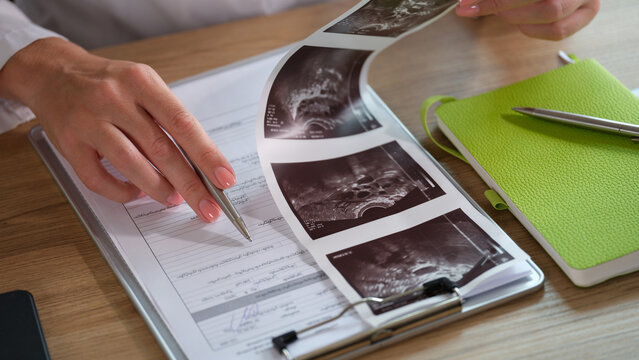 Female doctor analyzes results of patient's medical examination at her desk in clinic.