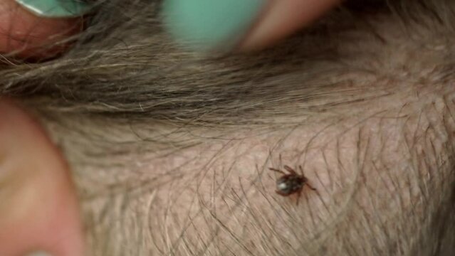 Close-Up of a Live Tick Being Found on a Dog's Bod