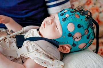 Study of a sleeping baby. Children's health. Electrical activity of the brain. Diagnosis of diseases and disorders. A sleep child EEG is a recording - obrazy, fototapety, plakaty