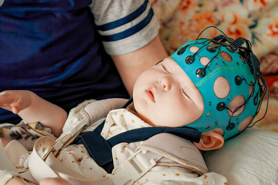 Electrical activity of the brain. Children's health. Study of a sleeping baby. A sleep child EEG is a recording. Diagnosis of diseases and disorders