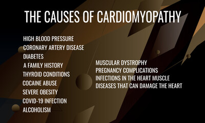 the causes of cardiomyopathy. Vector illustration for medical journal or brochure.