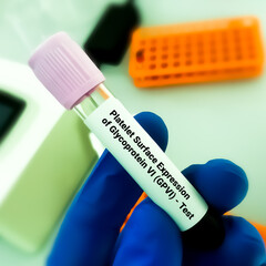 Platelet surface expression of glycoprotein VI (GPVI), diagnostic for various hereditary or...