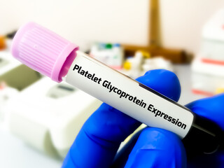 Platelet Glycoprotein Expression Test, for diagnosis of various hereditary or acquired platelet disorders including Bernard-Soulier syndrome or Glanzmann thrombasthenia.