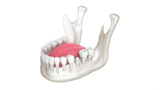 Mandible with dental crown embed on reshaped tooth over white background