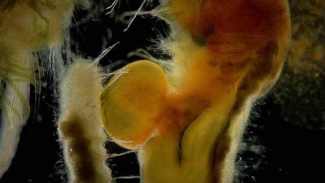 Worm Polychaeta family Terebellidae under a microscope, phylum Annelida. Damage to internal organs. White Sea