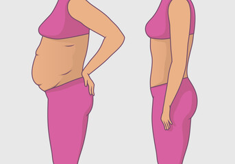 Vector illustration of a woman's body with a fat belly and a woman's body with a slender beautiful figure with contour, before and after exercise for weight loss