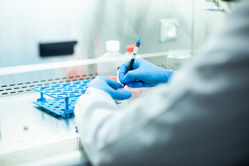 cell culture at the medicine, medical and cell culture laboratory