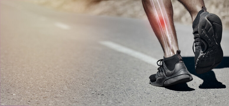 Injury, skeleton and pain of running athlete training, exercise or workout outdoors and legs that hurt. Closeup, discomfort and red bone for first aid emergency during fitness on legs or anatomy