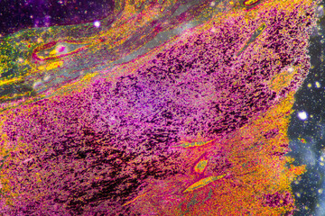 Chronic bronchitis disease human cells