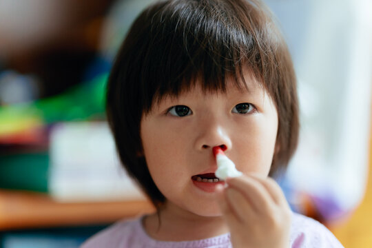 Child uses tissue to stop nosebleed