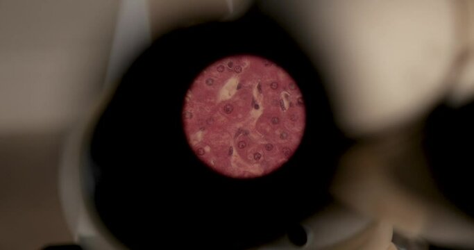 View through viewfinder of a microscope