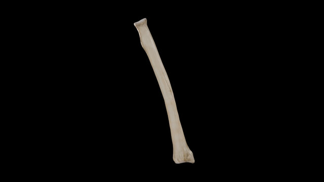 Posterior view of Right Radius