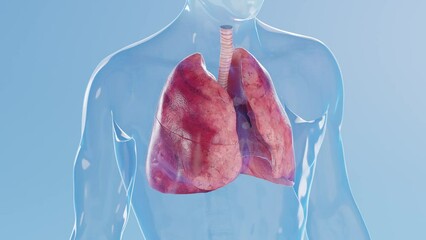 3D rendered medical animation of a man's inflamed lungs