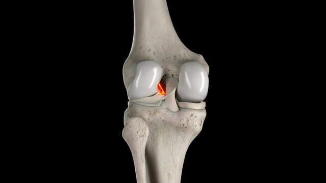 3D rendered medical animation of anterior cruciate ligament