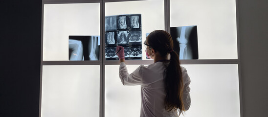 Radiologist checks x-ray image on light box