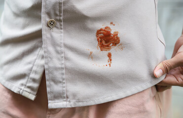Hand showing dirty sauce stain on shirt from accident in eating in daily life. selective focus....