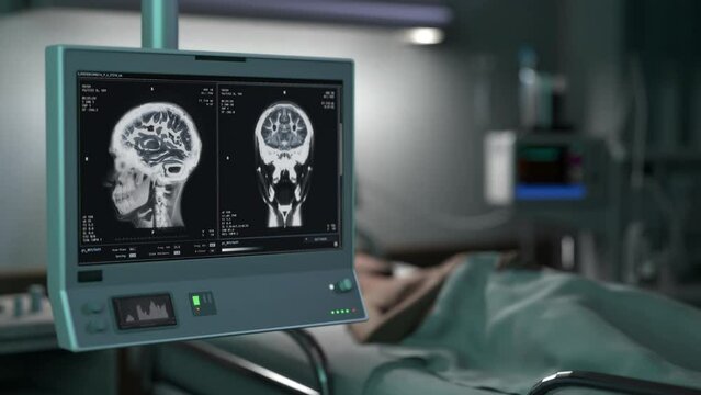 Diagnostic Scan Of Brain In Skull For Cancer Research In Modern Healthcare Clinic. Researching Patient Organ Cancer With MRI Scan Device. Cancer Disease Analysis. Medical Research Scan. Radiology