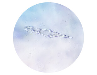 Schistosoma Haematobium Parasite in human urine specimen under microscope. Urinary parasite