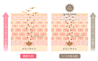 シミのできる肌のしくみ　ターンオーバー　肌細胞　ビフォアアフター